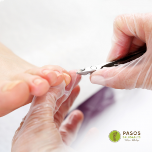 Tratamiento Onicomicosis