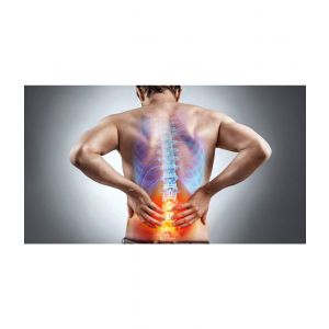 Tratamiento de lumbalgia