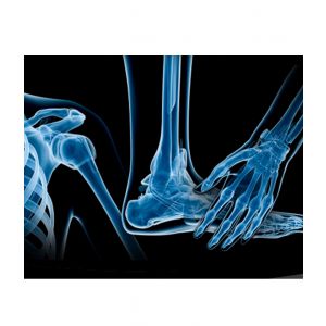 Ortopedia y Traumatología Medica